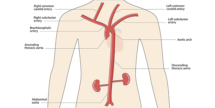 Abdominal Aorta Diagram