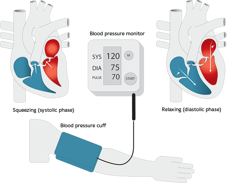 arm with a blood pressure cuff wrapped around the top of it. Blood pressure monitor showing systolic and diastolic blood pressure readings.